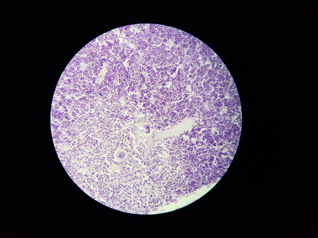Thymus Slides - Thymus 008 400X